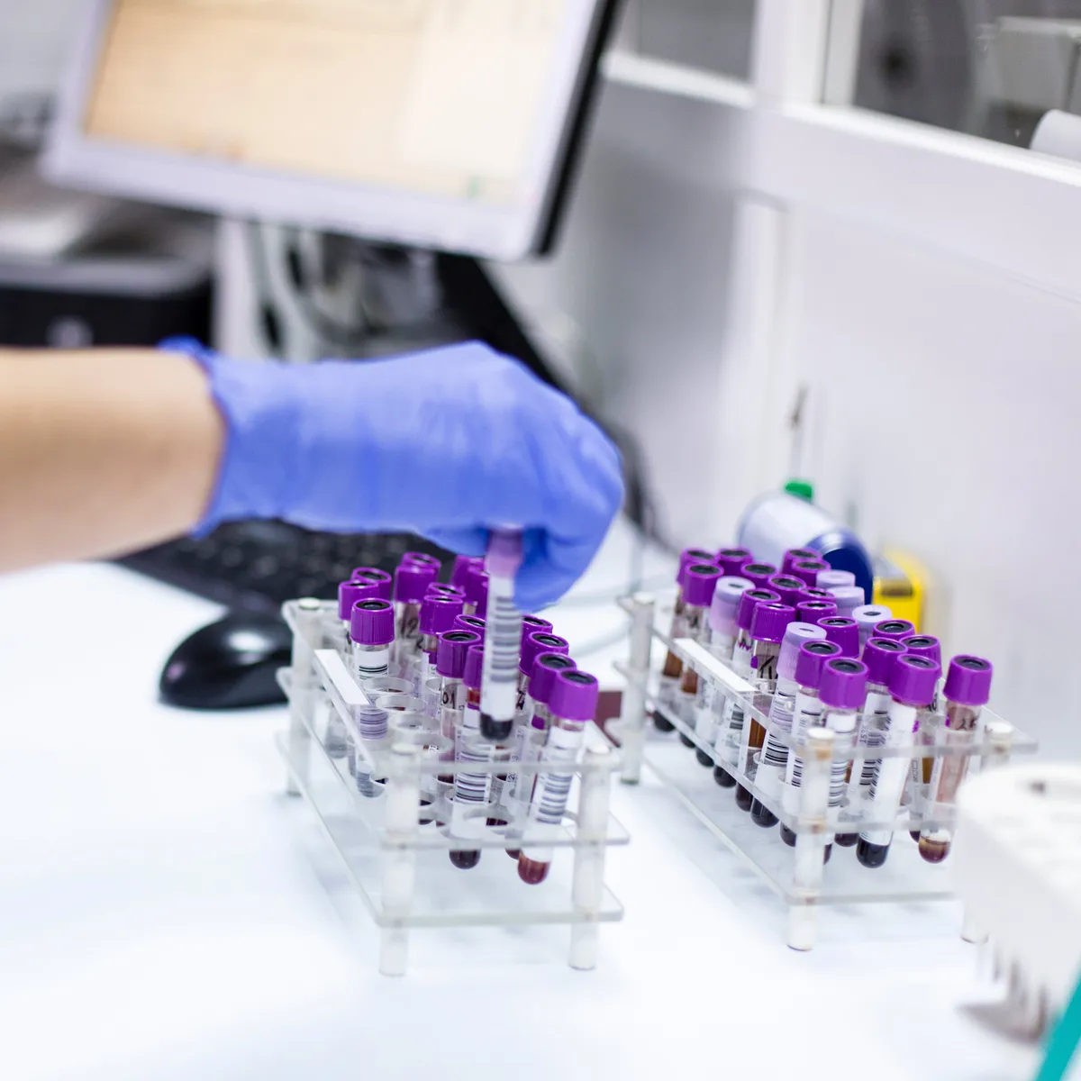 colorectal cancer — GB news